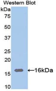 RNASE12 Antibody (aa21-147)