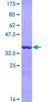 Human EEF1A2 Protein (Recombinant GST, N-terminus)