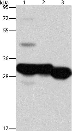 Polyclonal Rabbit anti-Human KHK / Ketohexokinase Antibody (WB)