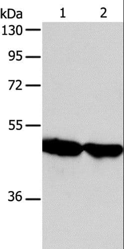 AADAC Antibody