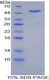 Mouse FURIN Protein (Recombinant His-GST)