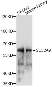 Polyclonal Rabbit anti-Human SLC2A9 / GLUT9 Antibody (WB)