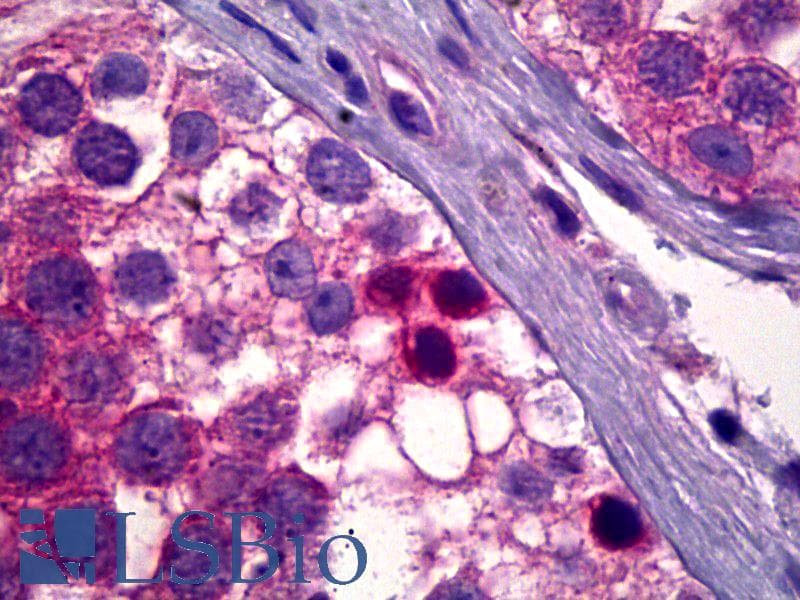 IHC-plus™ PDPK1 / PDK1 Antibody