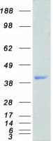 Human HNRPA1 / HnRNP A1 Protein (Recombinant Myc-DDK (Flag))