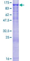 Human ST14 / Matriptase Protein (Recombinant GST)