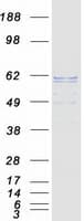 Human PLAP / Alkaline Phosphatase Protein (Recombinant Myc-DDK (Flag))