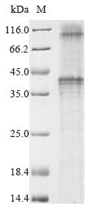 Rhesus monkey GnRH-II-R / GNRHR2 Protein (Recombinant 10His, N-terminus)
