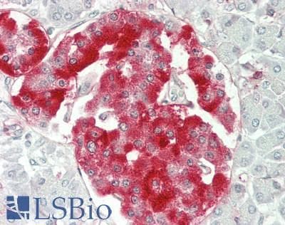 PTPRN / IA-2 Antibody (aa368-575)