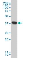 ATP6V0D1 Antibody (clone 2G12)