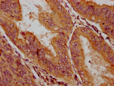 HLCS / HCS Antibody