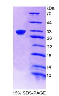 Pig EPCAM Protein (Recombinant His-T7)