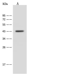 PME-1 / PPME1 Antibody