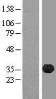 FAM70B Protein (Over-Expression Lysate Myc-DDK (Flag))