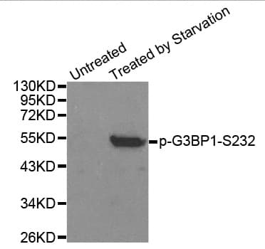 Polyclonal Rabbit anti-Human G3BP1 / G3BP Antibody (phospho-Ser232, IHC, IF, WB)