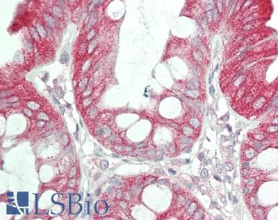 IHC-plus™ Polyclonal Rabbit anti-Human PAL / PAM Antibody (aa2425-2475, IHC, WB)