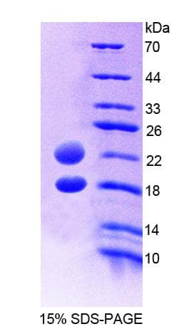 Human AVPI1 Protein (Recombinant His-T7, N-terminus)
