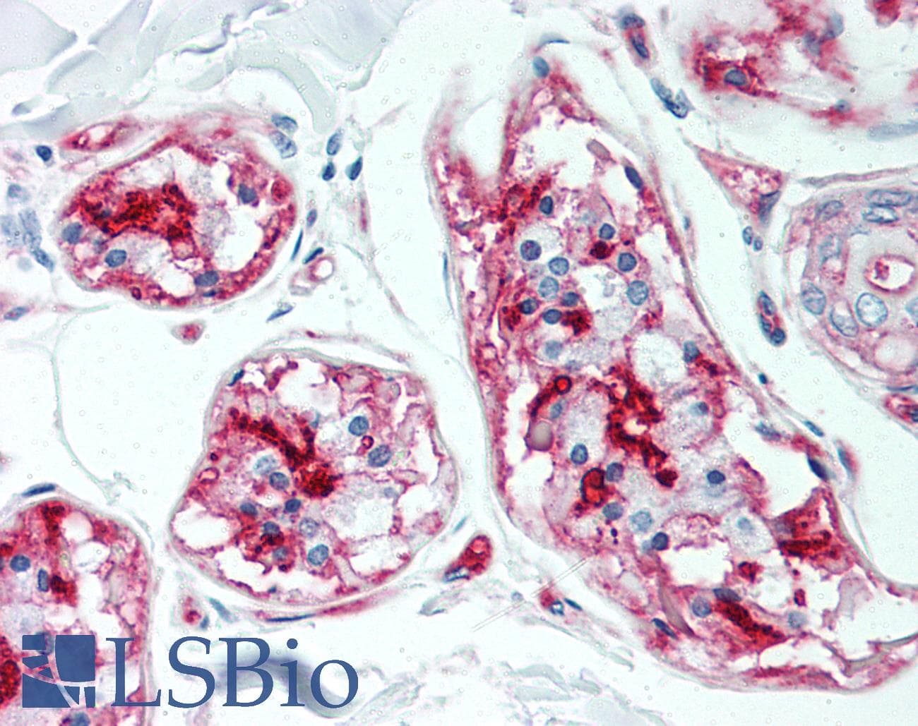 IHC-plus™ CD59 Antibody (clone MEM-43)