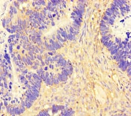 Polyclonal Rabbit anti-Human FAM71F2 Antibody