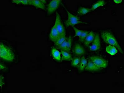 SHOC2 Antibody