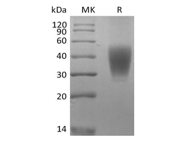 Rhesus monkey SLAMF7 / CRACC Protein (Recombinant 6His, C-terminus)