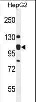 EMC1 Antibody (aa866-894)