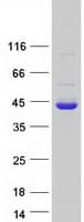 Human DDAH1 Protein (Recombinant Myc-DDK (Flag))