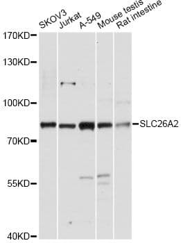 SLC26A2 Antibody