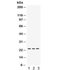 RAB14 Antibody