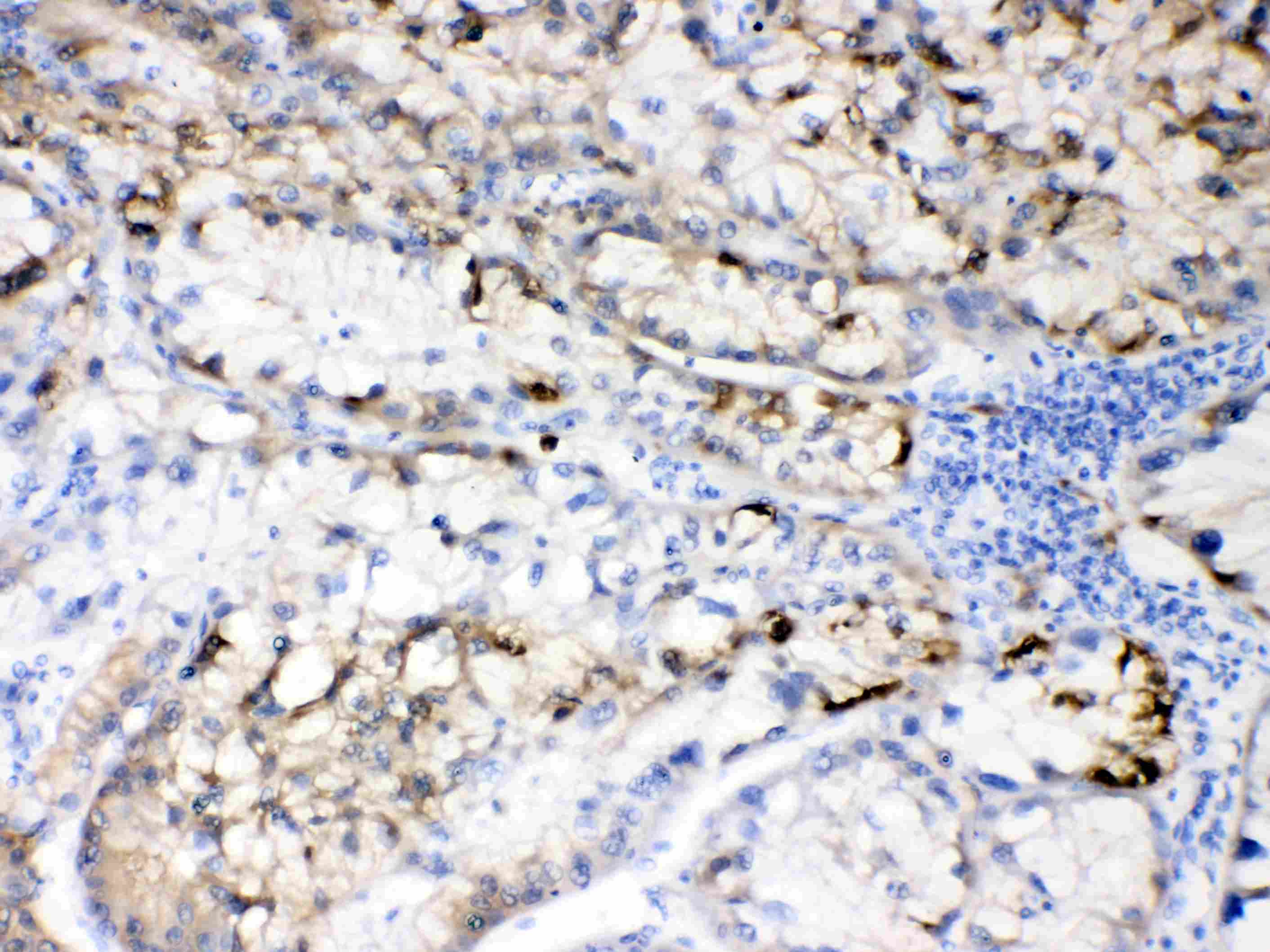 HBV / Hepatitis B Virus Antibody