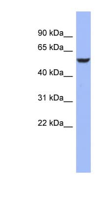 BRUNOL4 / CELF4 Antibody (aa287-336)