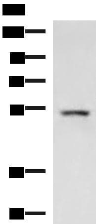 ONECUT1 / HNF6 Antibody