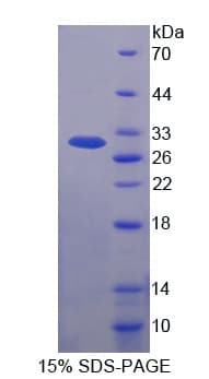 Human KARS Protein (Recombinant His-T7)