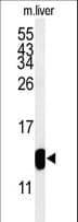 TMIE Antibody (aa71-100)