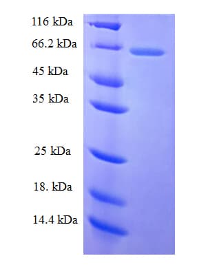 Rat MAC-2-BP / LGALS3BP Protein (Recombinant His)