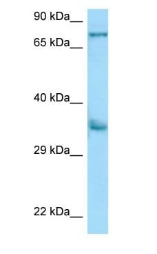 KIR2DS2 / CD158j Antibody (aa43-92)