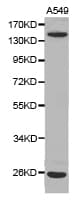 ITGAV/Integrin Alpha V/CD51 Antibody