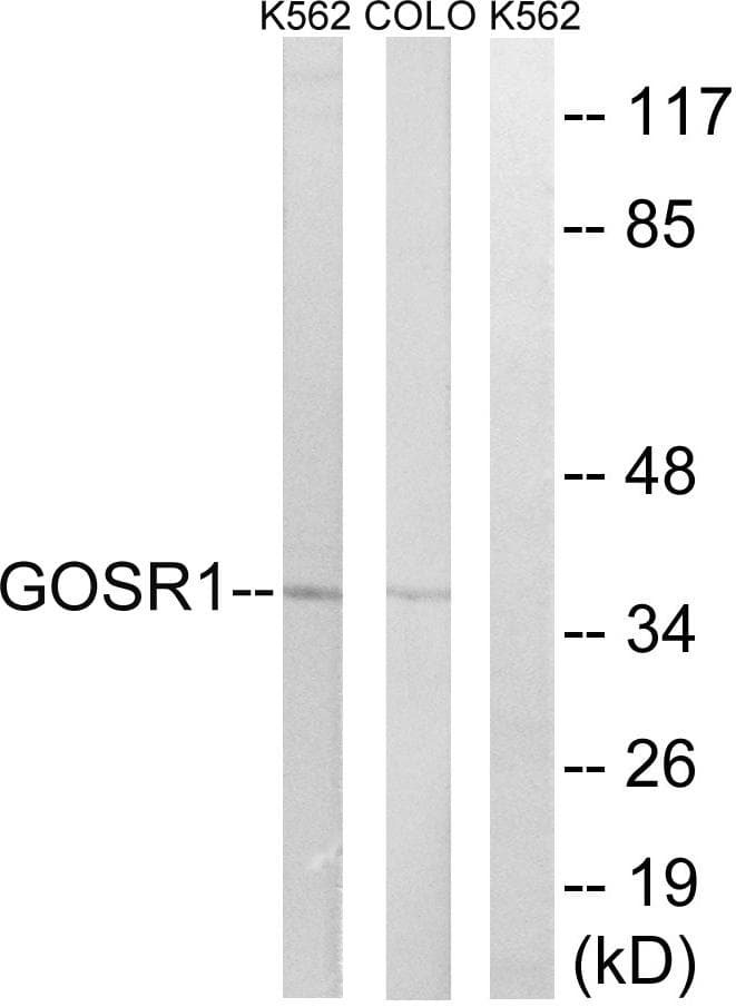 Polyclonal Rabbit anti-Human GS28 / GOSR1 / p28 Antibody (WB)