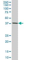 Monoclonal Mouse anti-Human TARBP2 / TRBP2 Antibody (clone 2H1, WB)