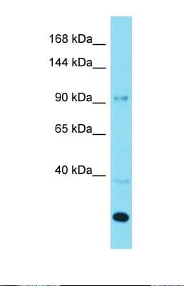 Polyclonal Rabbit anti-Human AGAP3 / CENTG3 / MRIP-1 Antibody (C-Terminus, WB)
