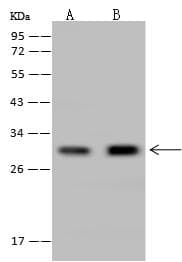 CUTC Antibody