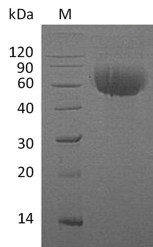 Human IL13RA1 / IL13R Alpha 1 Protein (Recombinant 6His, C-terminus)