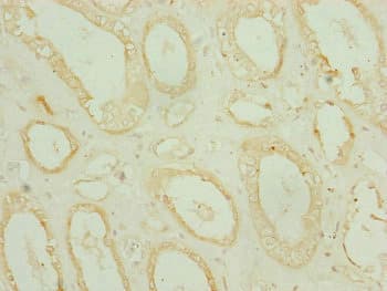 CHCHD3 Antibody