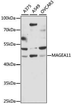 MAGEA11 Antibody