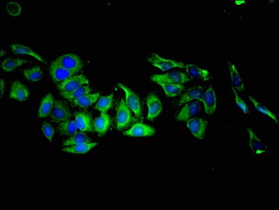 Polyclonal Rabbit anti-Human KLK8 / Kallikrein 8 Antibody (IHC, IF)