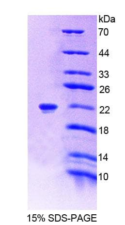 Human PTPRZ1 / Phosphacan Protein (Recombinant His-T7, N-terminus)
