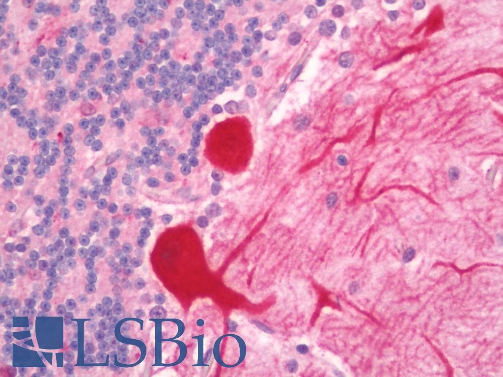IHC-plus™ GCLC Antibody (aa286-315)