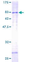 Human HDAC3 Protein (Recombinant GST)