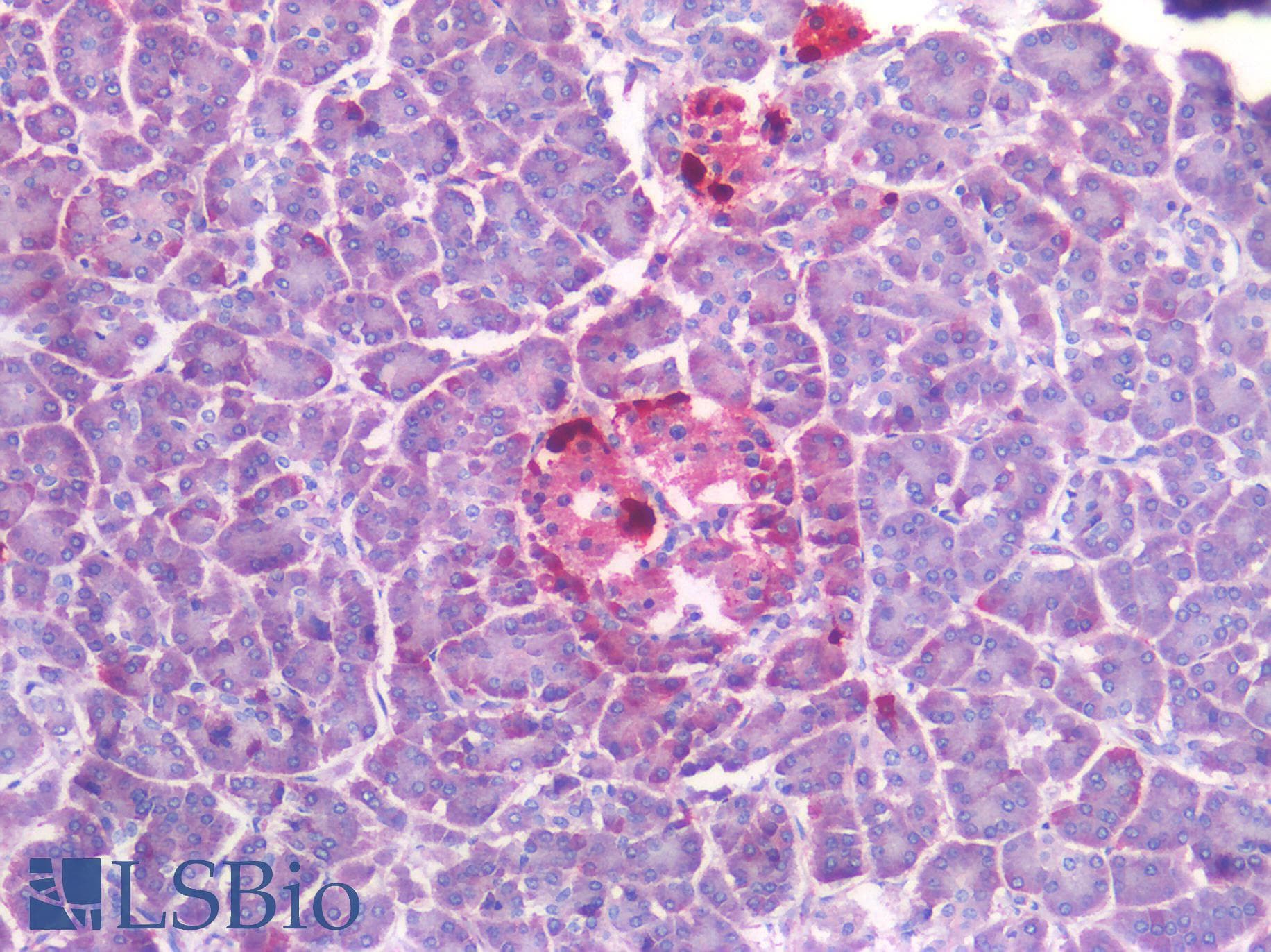 IHC-plus™ Polyclonal Rabbit anti-Human SST / Somatostatin Antibody (IHC)