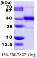 Human MPG Protein (Recombinant 6His, C-terminus)