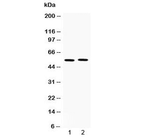 Polyclonal Rabbit anti-Human MMP11 Antibody (IHC, WB)